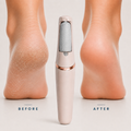 SOLEA™ Silk Pro