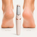SOLEA™ Silk Pro
